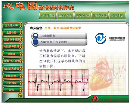 新版心电图教学软件
