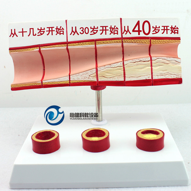 血脂胆固醇与年龄模型