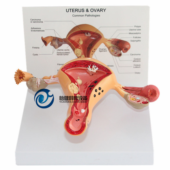 子宫、卵巢病理模型
