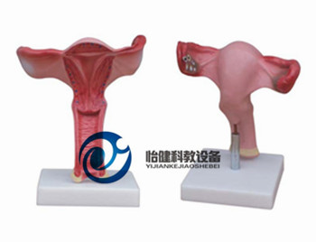子宫放大模型
