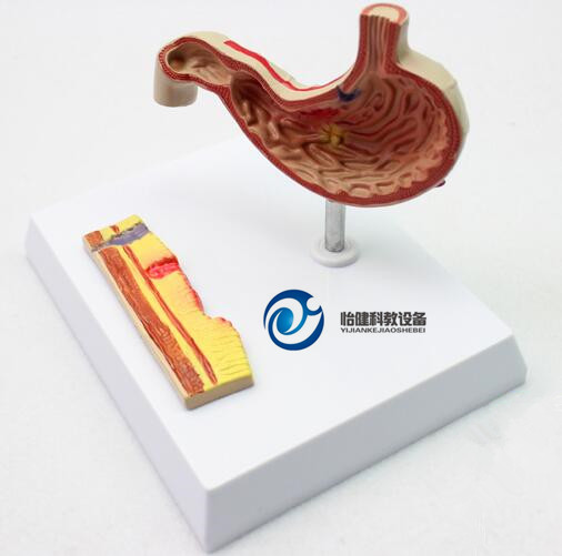 病理胃模型